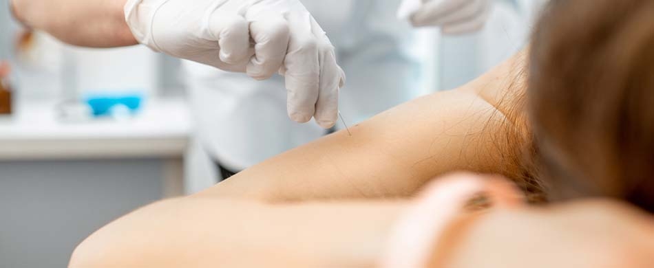 Acupuntura: terapia complementar