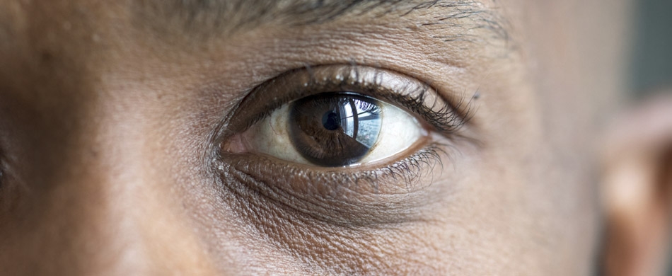 Saúde ocular: durma bem para proteger seus olhos!