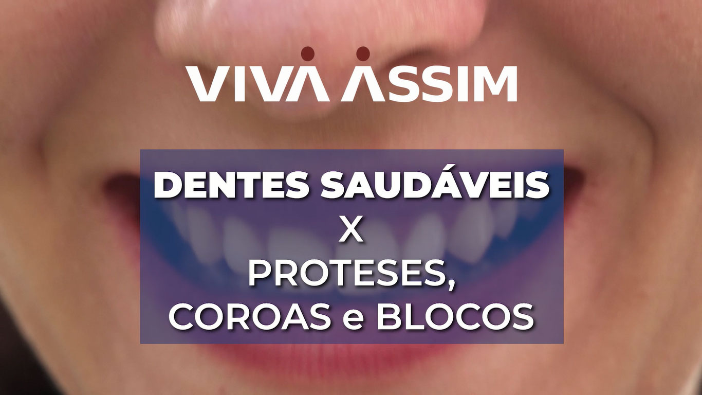 Dentes saudáveis x Proteses, Coroas e Blocos