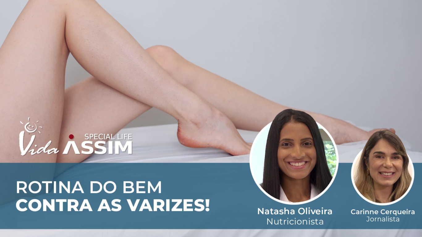 Rotina do bem contra as Varizes